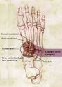 LISFRANC INJURY of the Foot: A Commonly Missed Diagnosis - July ...
