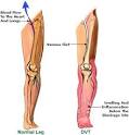 A <b>muscle cramp</b> can be seen and