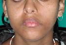 PRIMA - Modesta <b>asimmetria</b> del