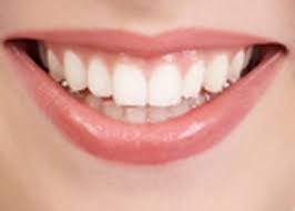 Produk Pemutih Gigi dapat Merusak Enamel