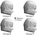 On the functional role of temporal and frontal cortex activation ...