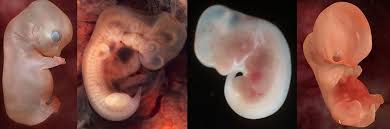 Científicos británicos crean los primeros embriones híbridos humano-animal Images?q=tbn:ANd9GcQnqUKiwt8_E87mmq9bRbSQMvT18hl5OFPzbRs6rVr5qx7rgPB8