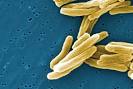 Mycobacterium <b>tuberculosis</b>