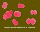 of <b>Neisseria gonorrhoeae</b>,