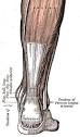 <b>Tendon</b>