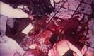 Crime Scene Photographs, Nicole Brown Simpson and Ronald Goldman/