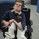 <b>Muscular</b> Dystrophy Treatment :