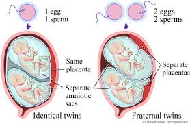 tentang kehamilan kembar