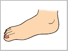 TO VIEW THE 2011 <b>FOOT</b> CLINIC