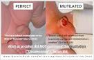 QuranicPath | Circumcision - Does the Quran Approve it? - Genital ...
