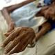 Aumento de casos de tuberculosis prende las alarmas en Norte de ... - RCN Radio (blog)