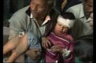 Thane: 44 CHILDREN INJURED IN ROAD MISHAP - India News - IBNLive