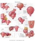 Conditions Simulating Ovarian <b>Neoplasms</b>-Differential Diagnosis