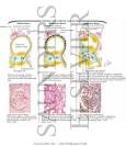Pathology of the Nephrotic Syndrome - Netter Medical Artwork