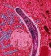 <b>Malaria</b>