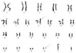 <b>cytogenetic analysis</b> of