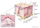 <b>Merkel cell carcinoma</b> tends to
