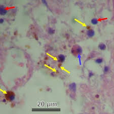 Image result for hemocytosis