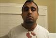 Atul Lall, who is 32, was attacked while leaving a parking centre where he ... - Indian-man-jaw-broken-tequila-295x200