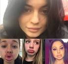 Kylie Jenner Challenge is Taking Over the Net and Its GROSS! (VIDEO.