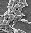 <b>Campylobacter infection</b>
