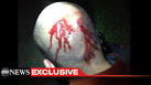 Reasonable Doubt? Crime Scene Photos Shows Serious Injury On ...