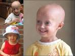 <b>Progeria</b> - a very rare genetic