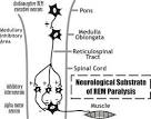 <b>REM Sleep Behavior Disorder</b>