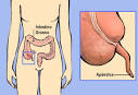 <b>Apendicite</b>