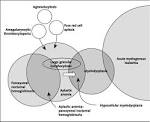 between <b>aplastic anemia</b>