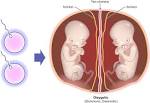 Cómo se diagnostica el Síndrome de Transfusión de <b>gemelo</b> a <b>gemelo</b>?