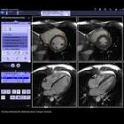 4D <b>Ventricular Function</b>
