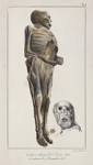 Visible Proofs: Forensic Views of the Body: Galleries: Biographies ...