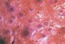 156: <b>Sheep</b> pox.