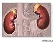 <b>Enfermedades</b> de las glándulas suprarrenales: MedlinePlus en español