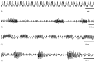 in the <b>decerebrate</b>,