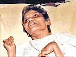 ARUNA SHANBAUG, who was in a vegetative state for 42 years after.