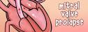 <b>Mitral Valve Prolapse</b>