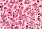 <b>Mycobacterium</b>