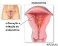 as <b>tubas uterinas</b> podem