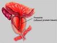 <b>Prostatitis</b>