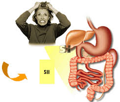 síndrome de intestino irritable 