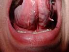 What is on Keith's tongue? - Boing Boing