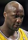 LAMAR ODOM Head Pictures After Stitches lamar-odom-head – Larry ...
