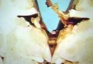 <b>Heredodegenerative Disorders</b>, <b>Nervous System</b> www.lookfordiagnosis.com