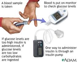 Blood Glucose Ranges