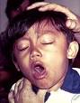 A young boy <b>coughing</b> due to
