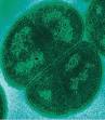 Deinococcus radiodurans - Wikipedia, the free encyclopedia