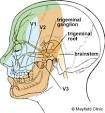 What is trigeminal <b>neuralgia</b>?