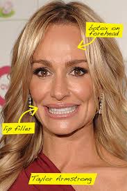 Taylor Armstrong tells us she